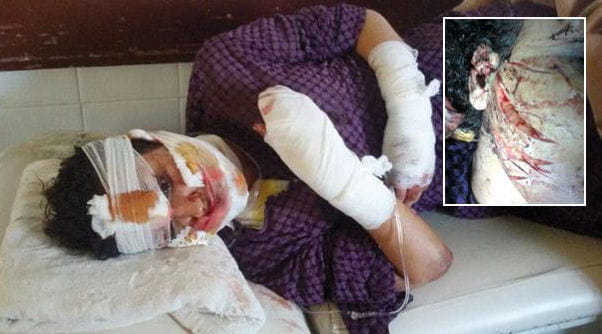 marocaine dã©figurã©e capture d'ã©cran du site alakhbar