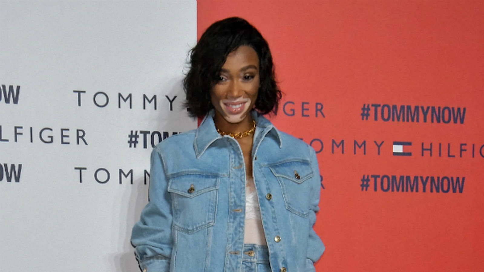 Winnie Harlow