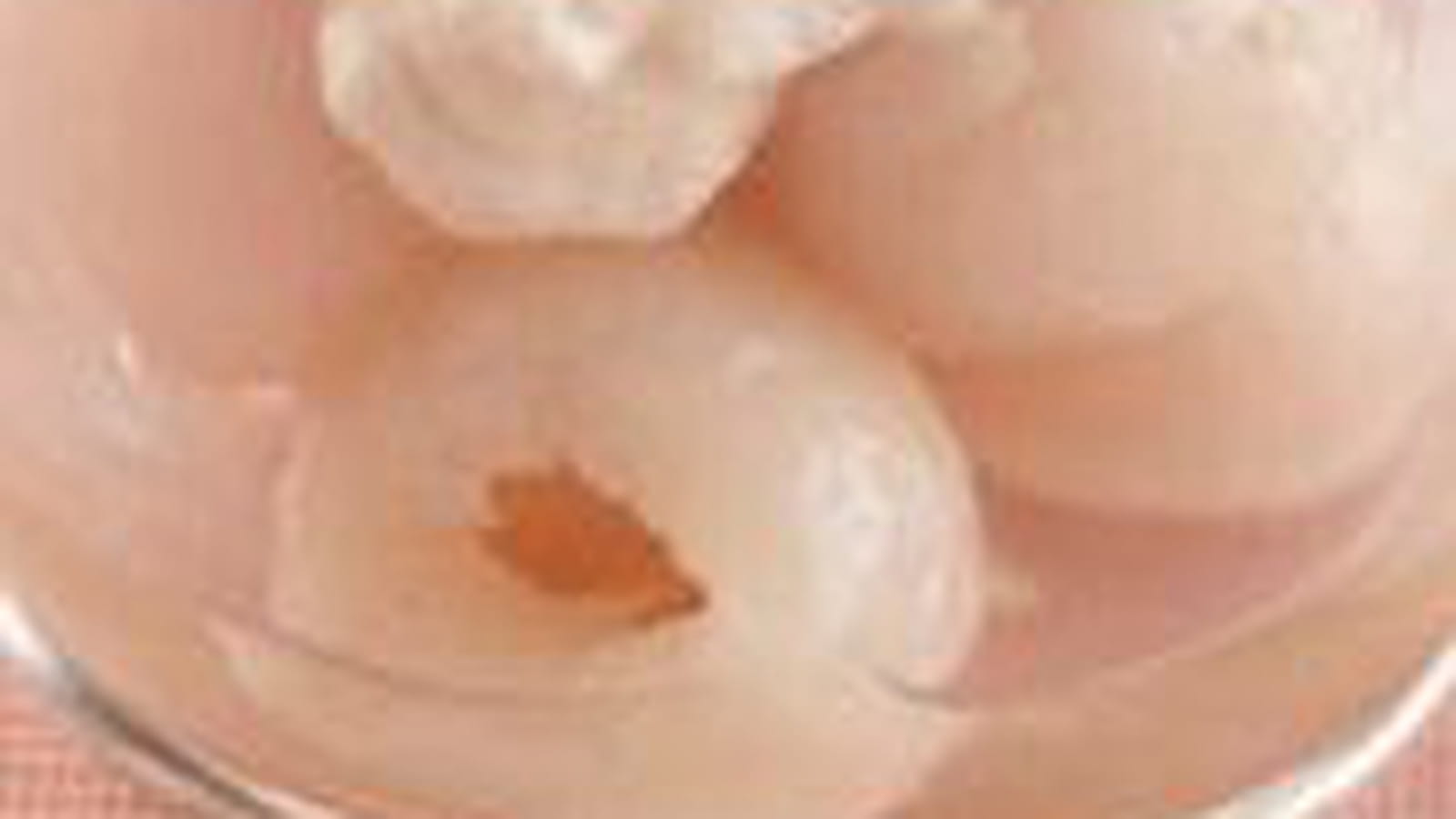 Litchis mousse gingembre