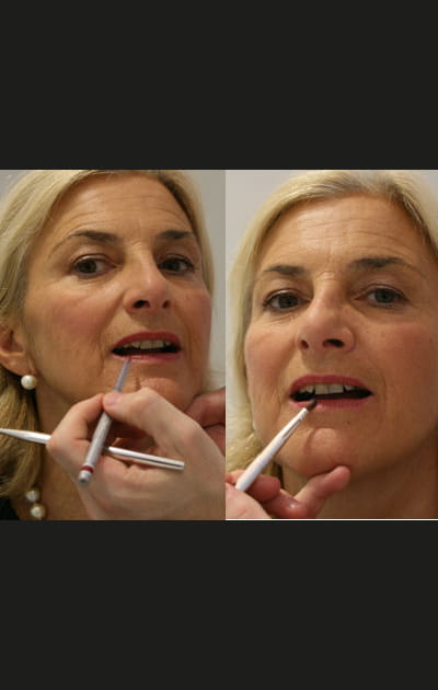 Camoufler les taches pigmentaires&nbsp;: La mise en beaut&eacute; des l&egrave;vres