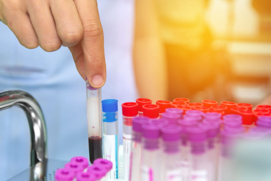 Sérologie : comment interpréter les résultats d'un test sérologique ?