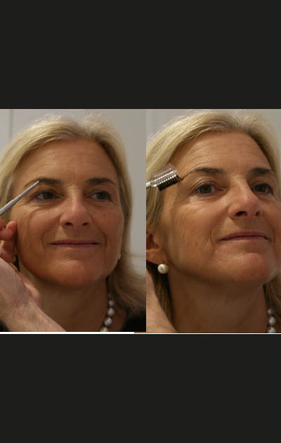 Camoufler les taches pigmentaires&nbsp;: La beaut&eacute; du regard