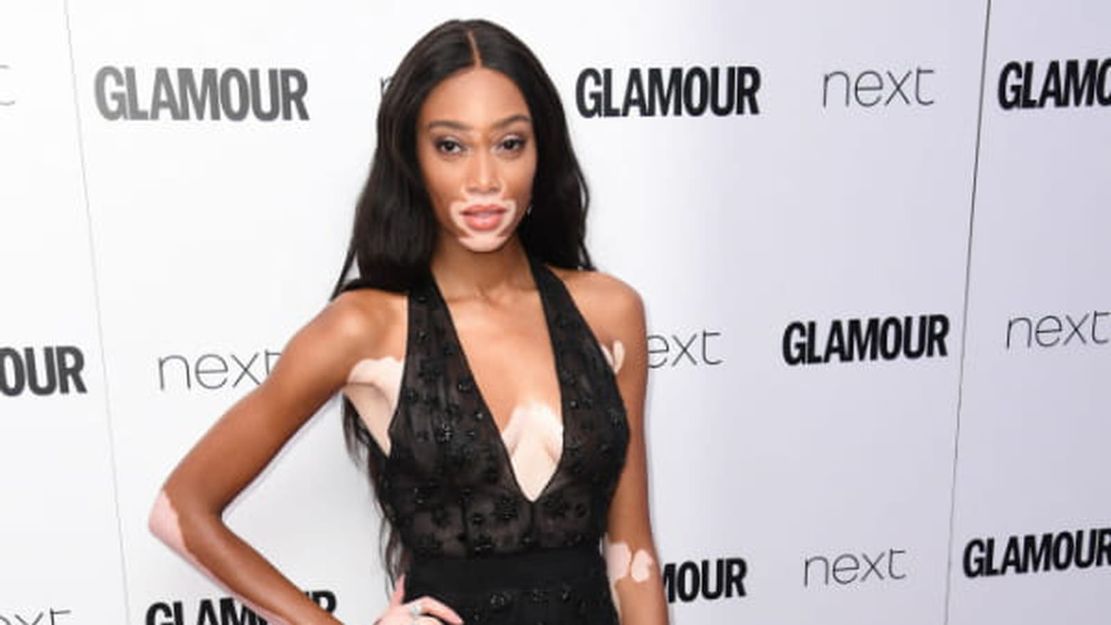 Winnie Harlow le 6 juin 2017