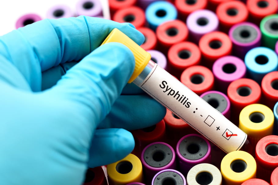 Syphilis : symptômes, transmission et traitements