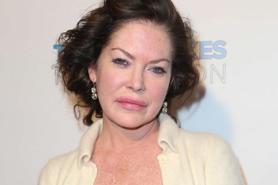 Lara Flynn Boyle, apr&egrave;s&nbsp;: une bouche disproportionn&eacute;e