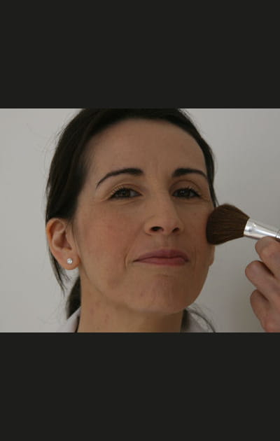 Camoufler ses boutons&nbsp;: l'effet bonne mine