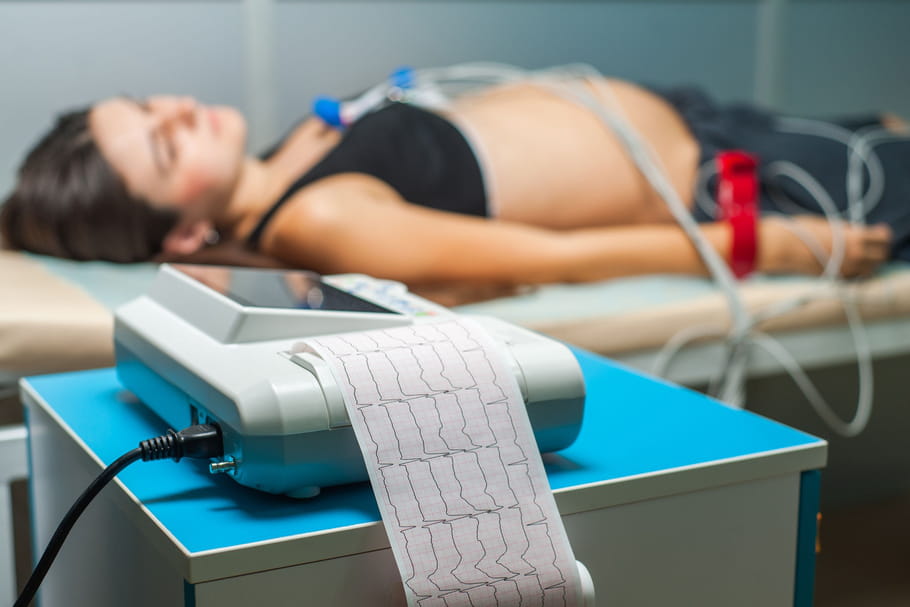ECG : principes du test, interprétation d'un électrocardiogramme