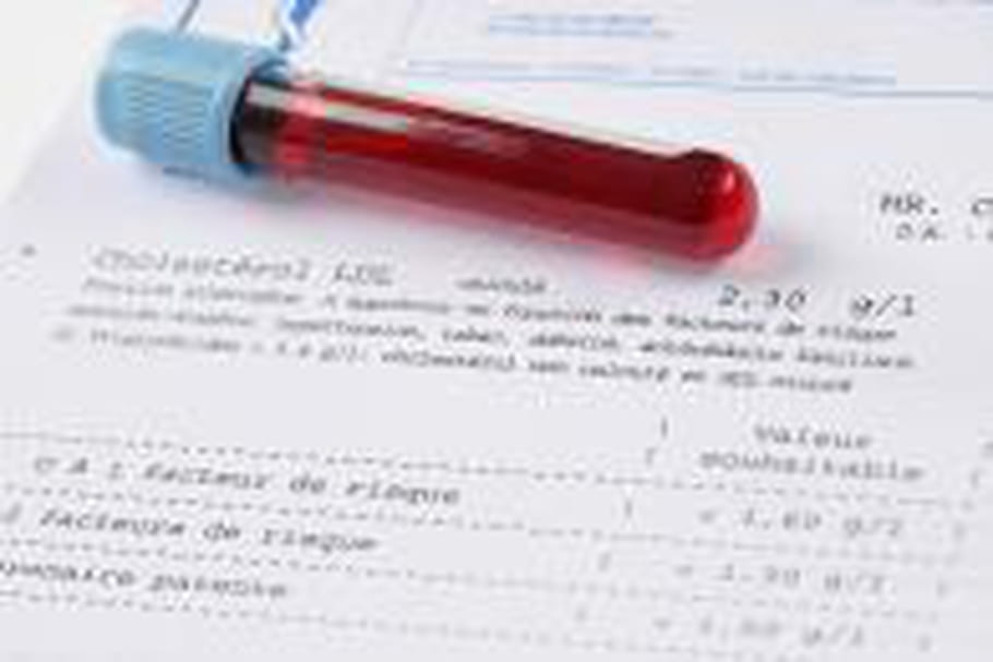 Le temps de coagulation sanguine