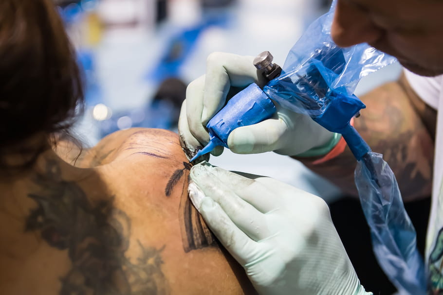 Comment enlever un tatouage ?