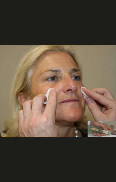 Camoufler les taches pigmentaires&nbsp;: le nettoyage de peau au savon