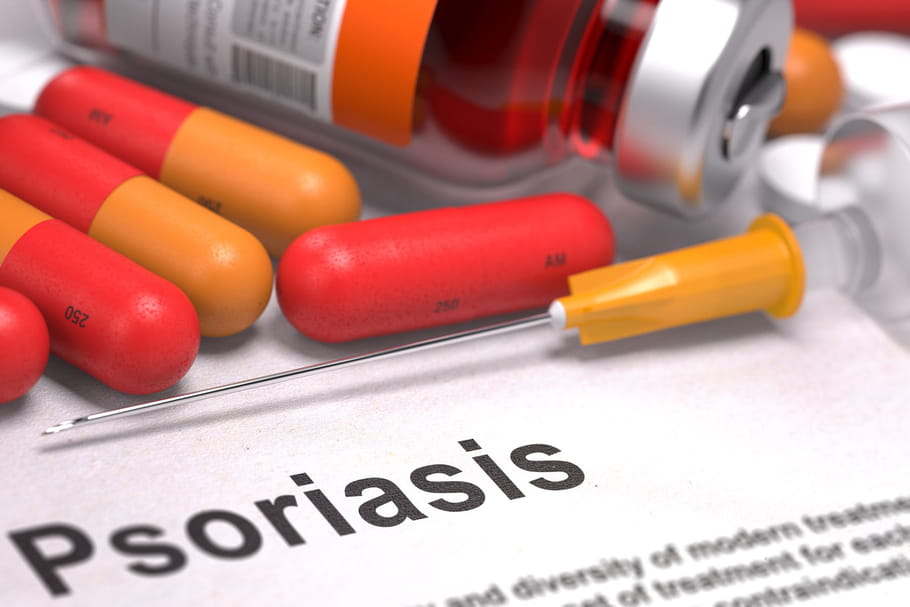 Tremfya : un nouveau médicament pour soulager le psoriasis
