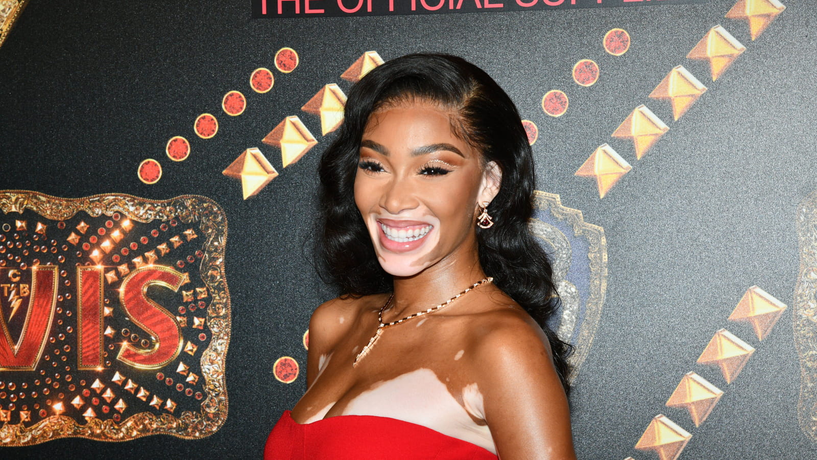Winnie Harlow