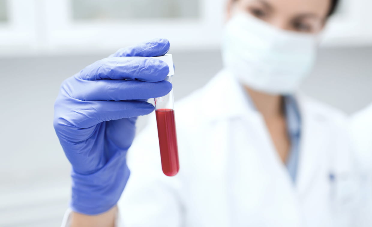 Virus Vih Sida Symptomes Transmission Traitements