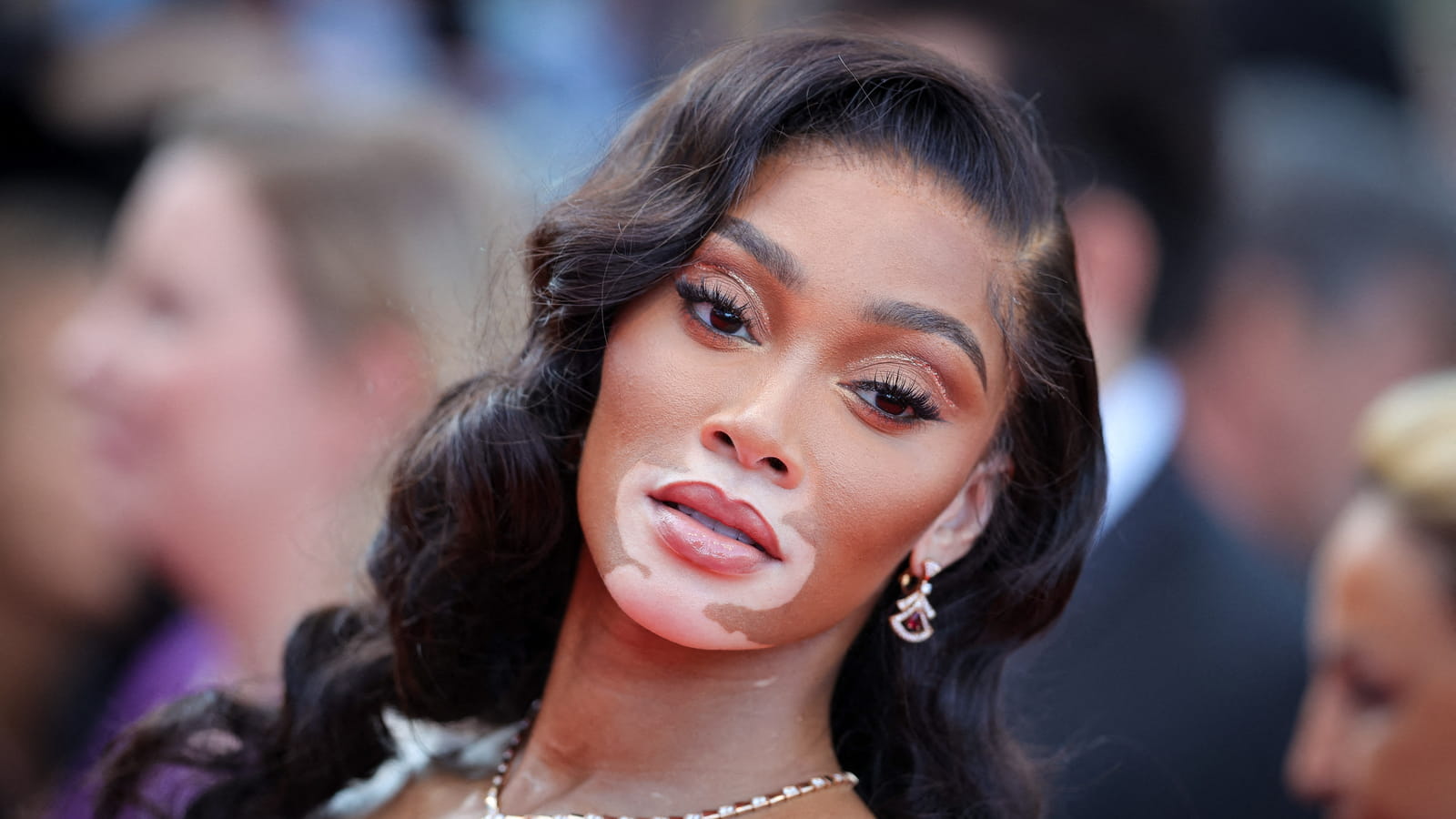 Winnie Harlow