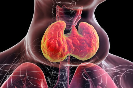 Image de la glande thyroide