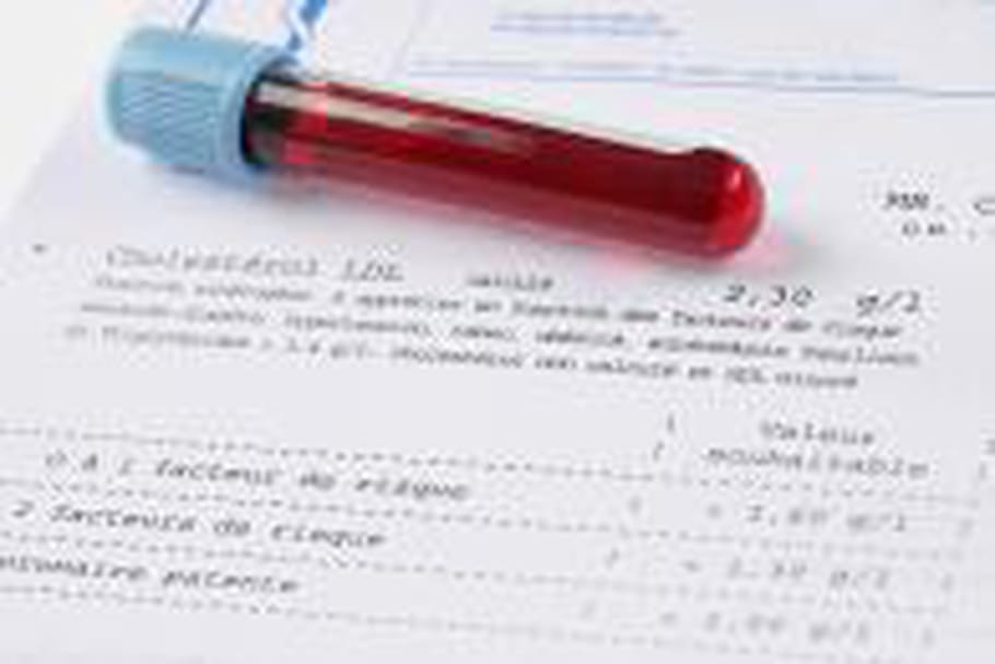 Le diagnostic sérologique de la syphilis