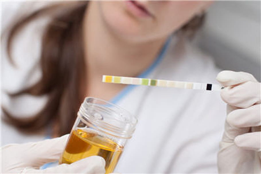 Papillomavirus : et pourquoi pas le détecter avec un test urinaire ?