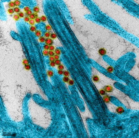 image du virus sars-cov-2 covid-19
