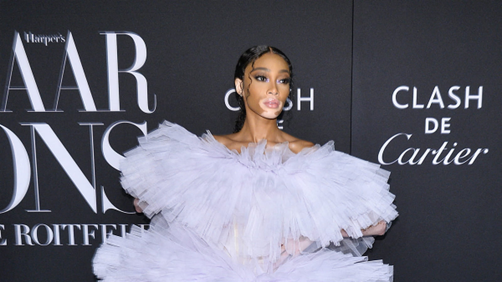 Winnie Harlow