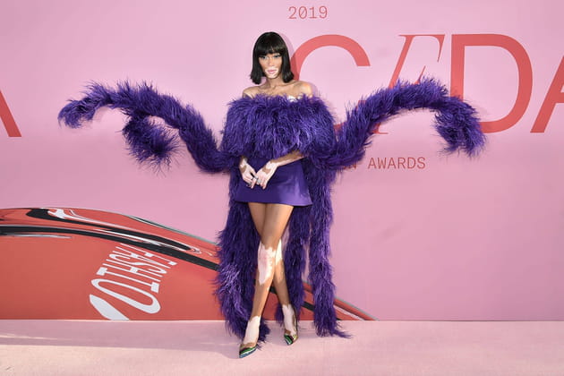 Winnie Harlow, au poil