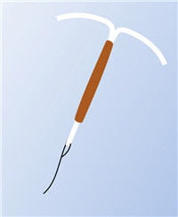 stérilet.