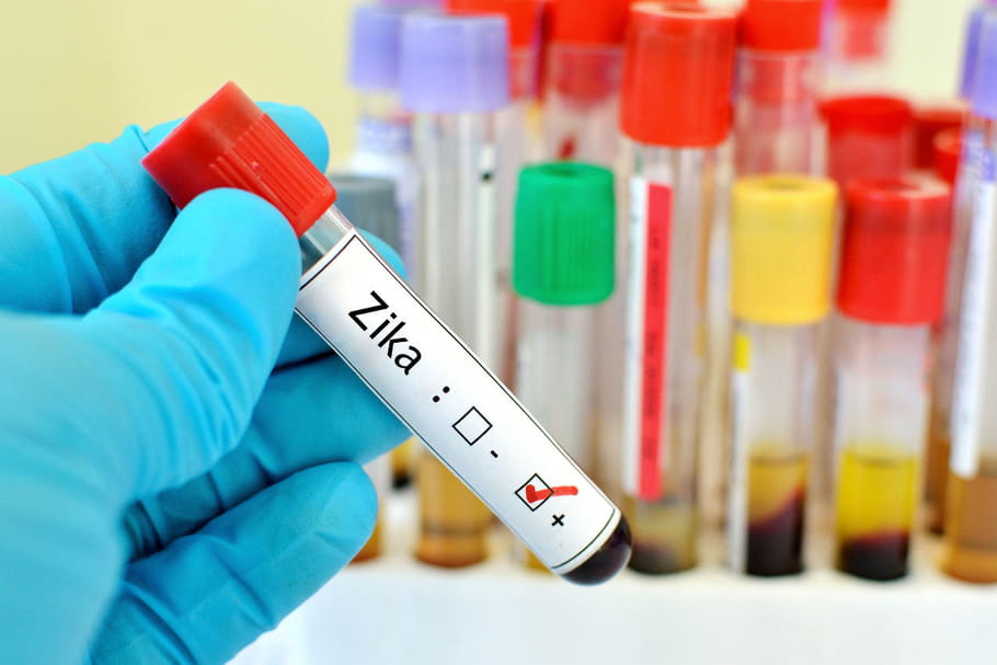 Le virus Zika est une urgence mondiale selon l'OMS