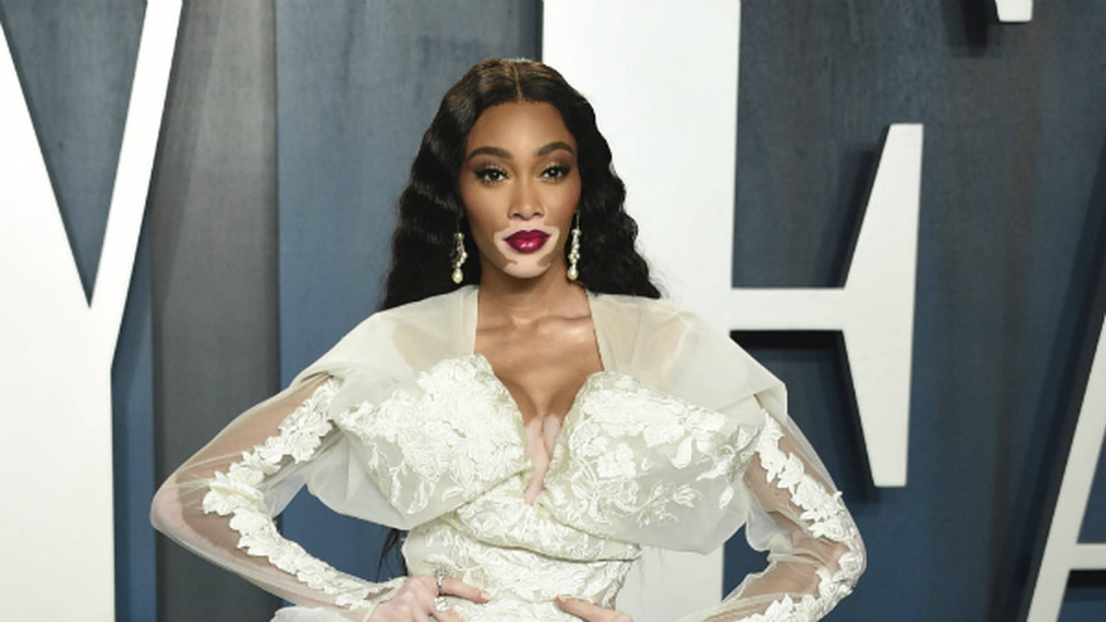 Winnie Harlow 