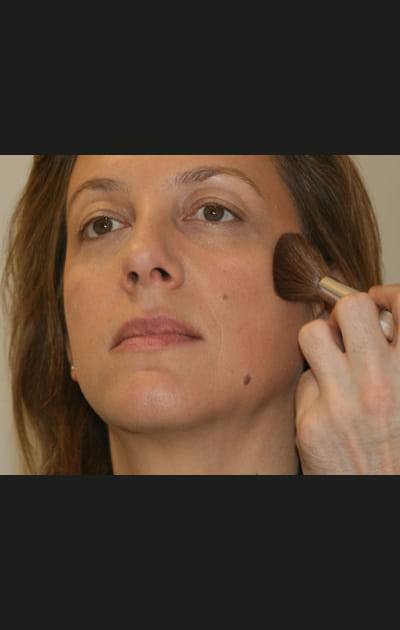 Comment cacher les rougeurs du visage&nbsp;: la poudre de soleil