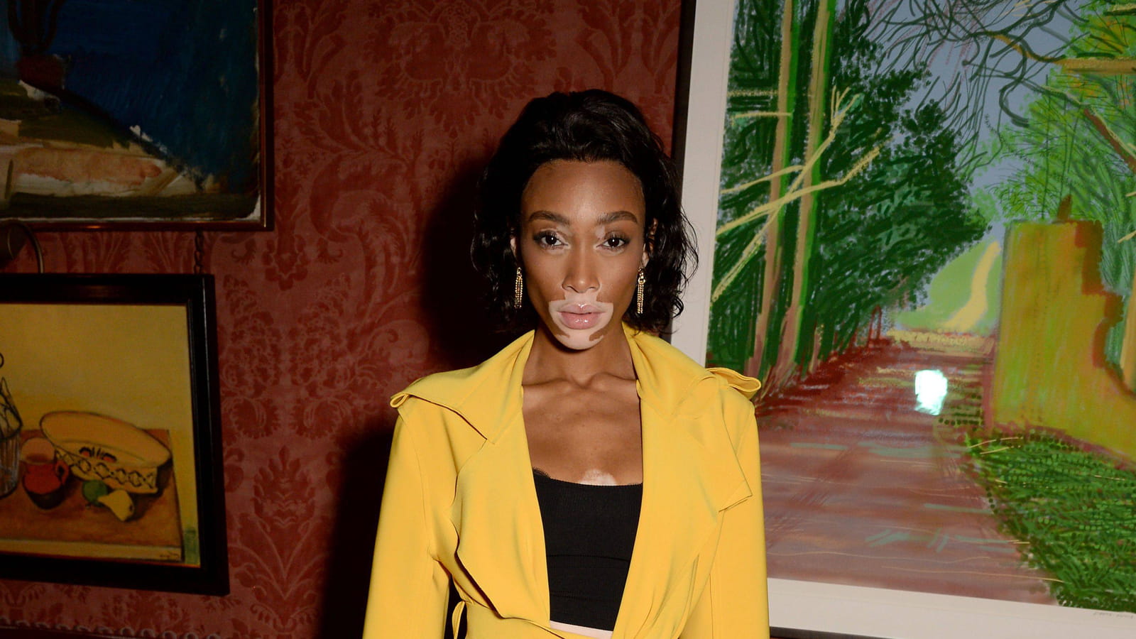 Winnie Harlow