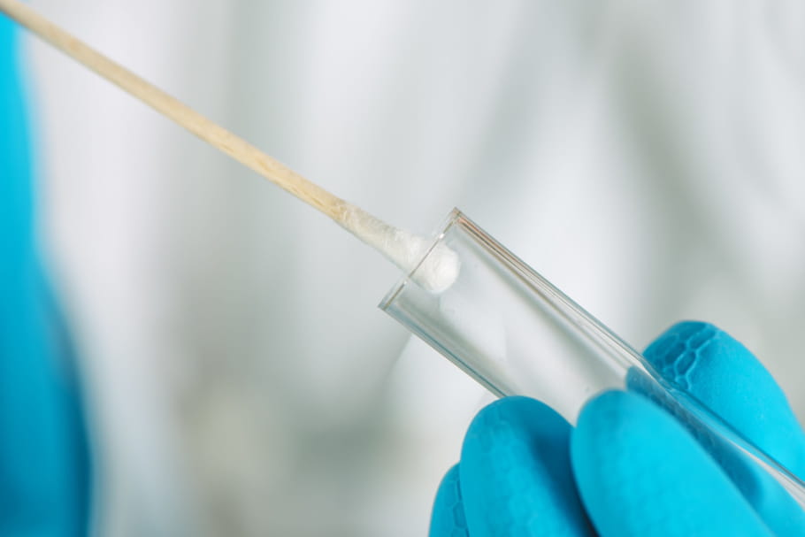 Test du chromosome Y : comment faire, autorisé en France ?