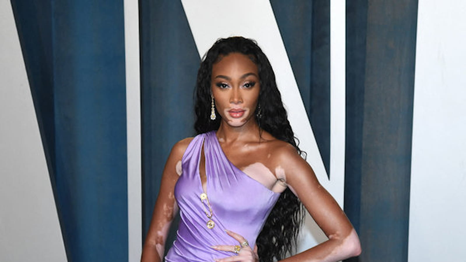 Winnie Harlow