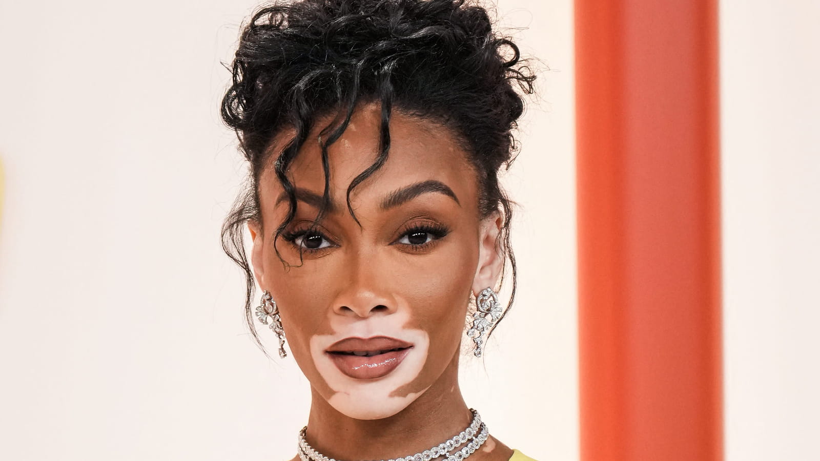 Winnie Harlow