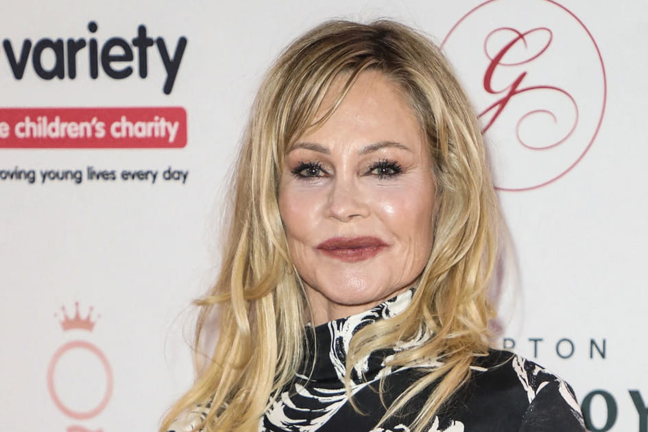 Melanie Griffith, apr&egrave;s&nbsp;: des l&egrave;vres pleines