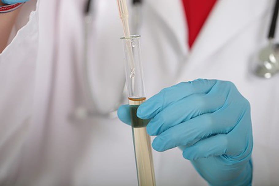 Ebola : les tests de la patiente hospitalisée à Bichat sont négatifs