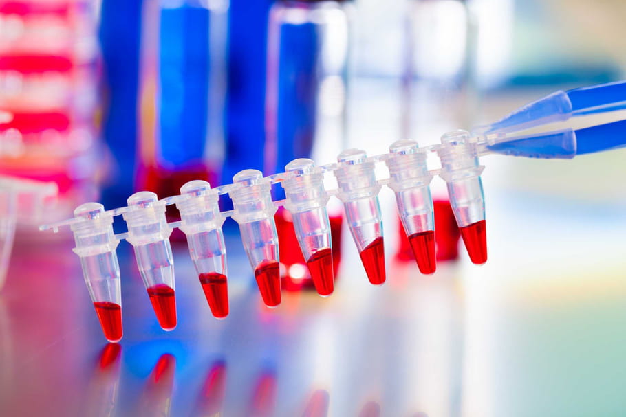 Cancer : l’immunothérapie, porteuse d’espoir