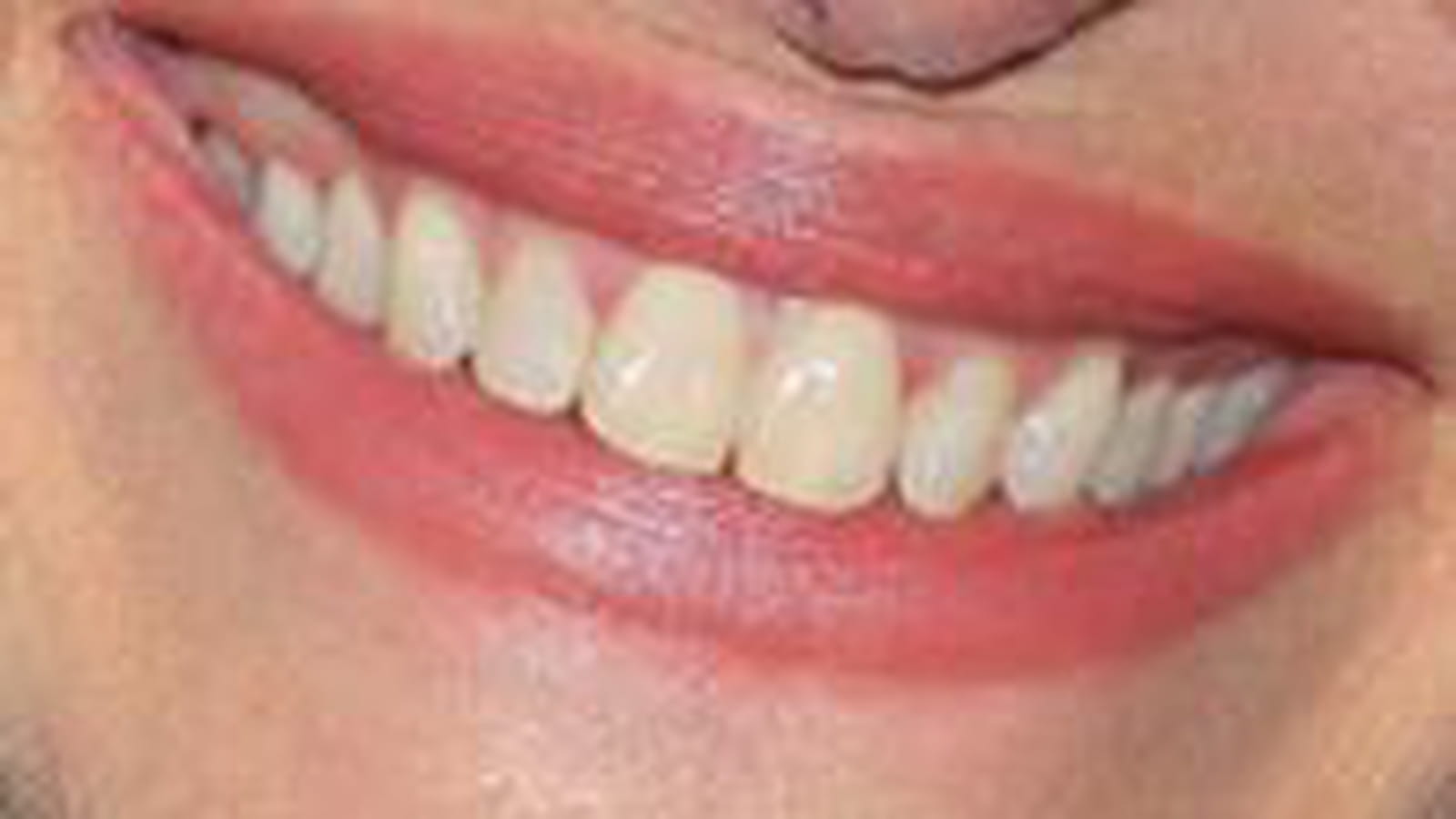 Grand sourire ?