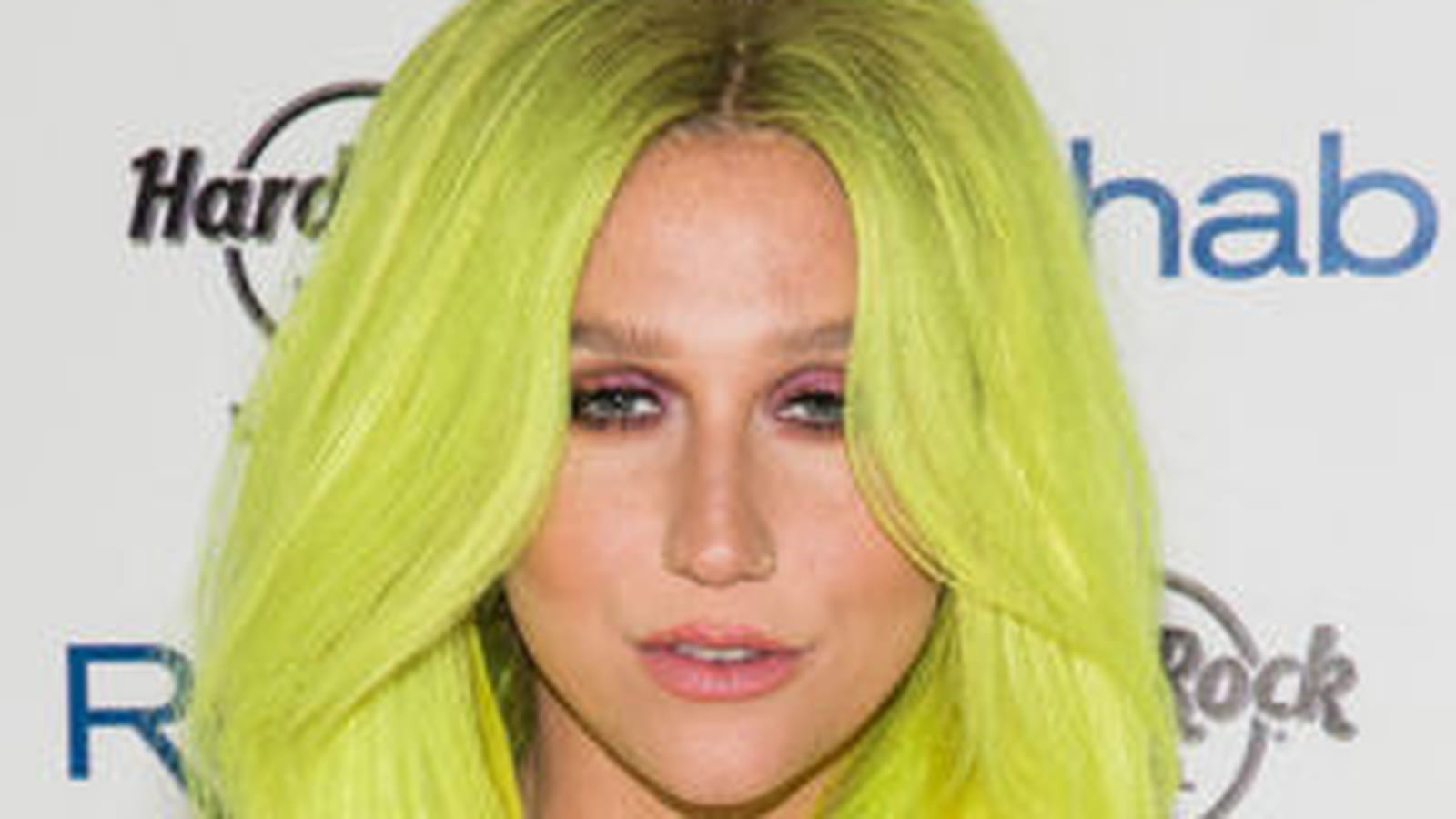 Kesha 