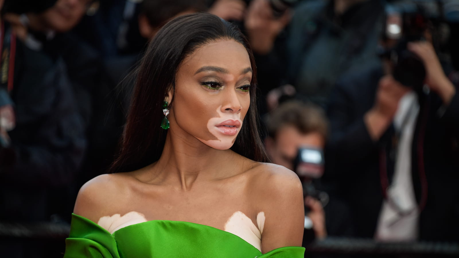 Winnie Harlow
