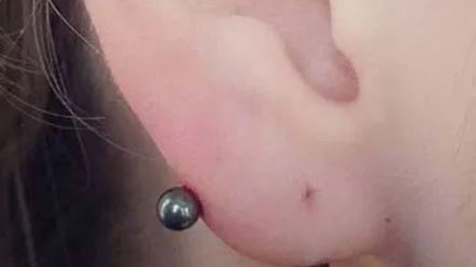 Les boules simples au lobe transversal