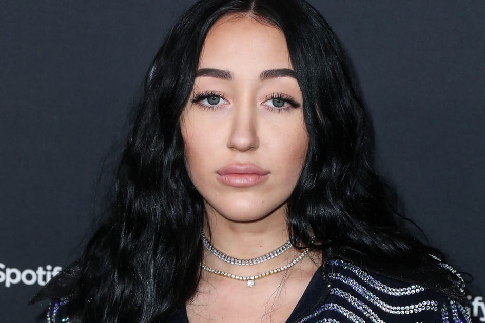 Noah Cyrus, apr&egrave;s&nbsp;: une bouche gonfl&eacute;e