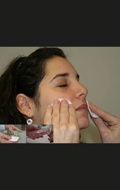 Les pores&nbsp;: nettoyer le visage