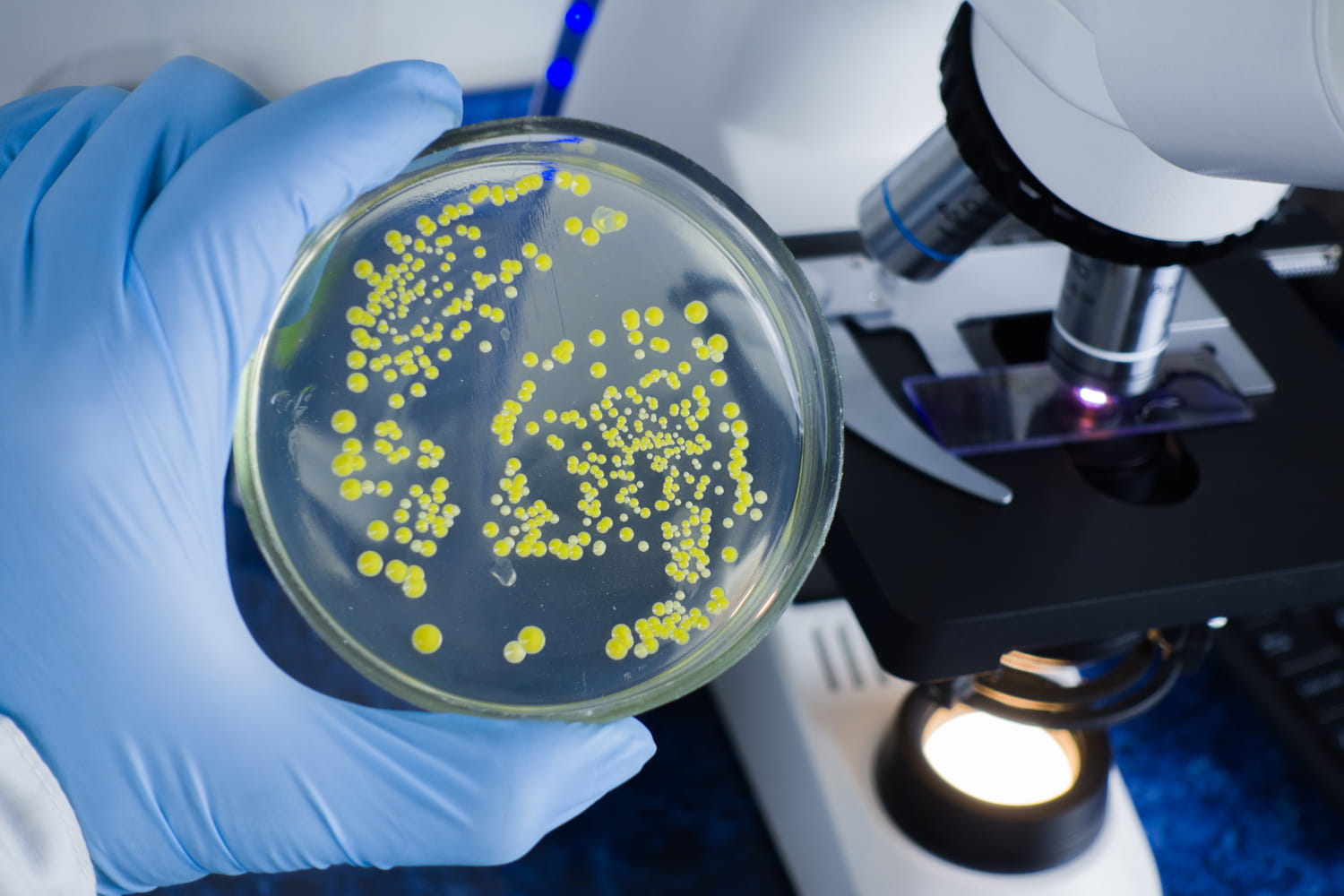 This bacteria causes fatal infarction, millions of people concerned