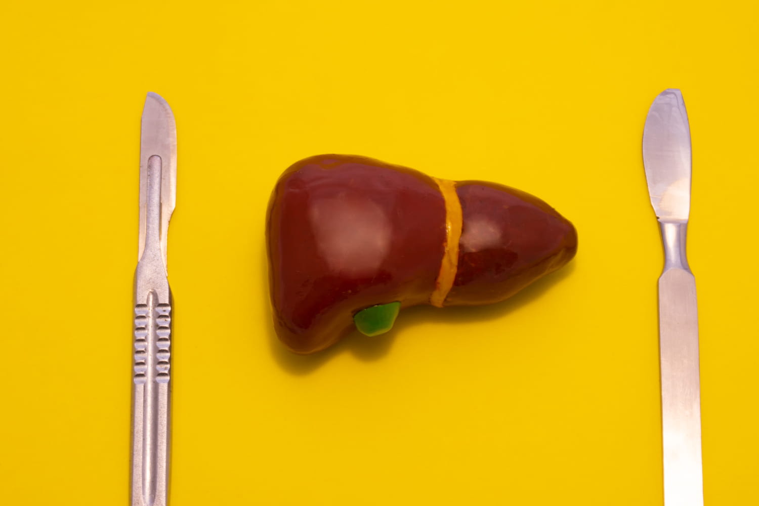 Greffe du foie : indication, risques, taux de réussite