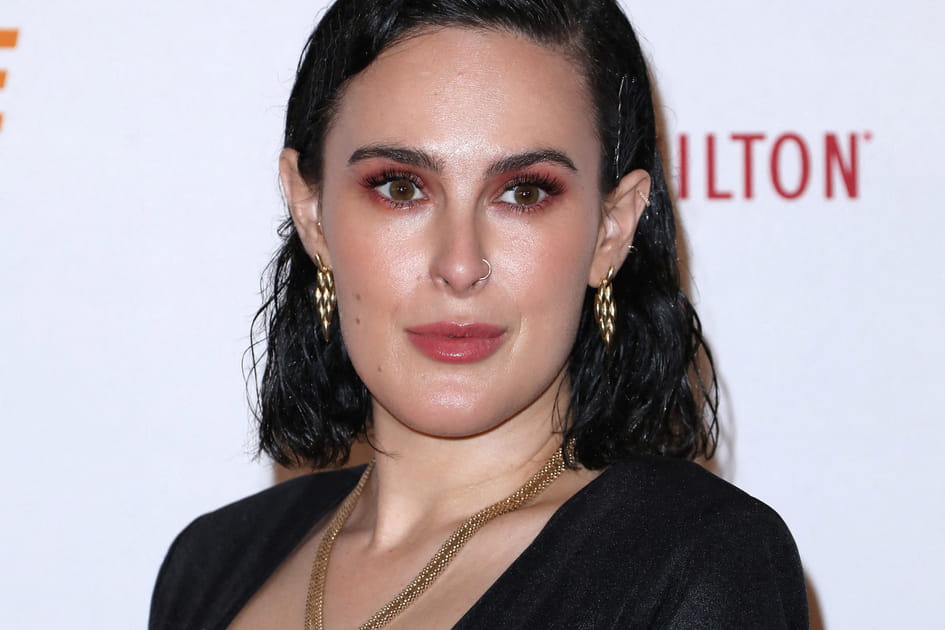 Rumer Willis, apr&egrave;s&nbsp;: des l&egrave;vres plus pr&eacute;sentes