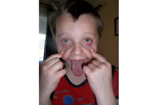 Janin, grimaceur professionnel