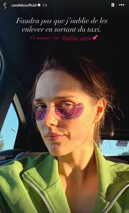 story-Instagram-Camille-Lou-patch-yeux