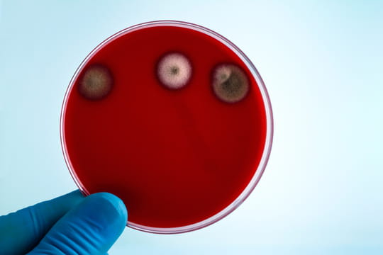 C'est quoi le &quot;Candida auris&quot; qui&nbsp;se propage dans les h&ocirc;pitaux europ&eacute;ens&nbsp;? Quels sympt&ocirc;mes&nbsp;?