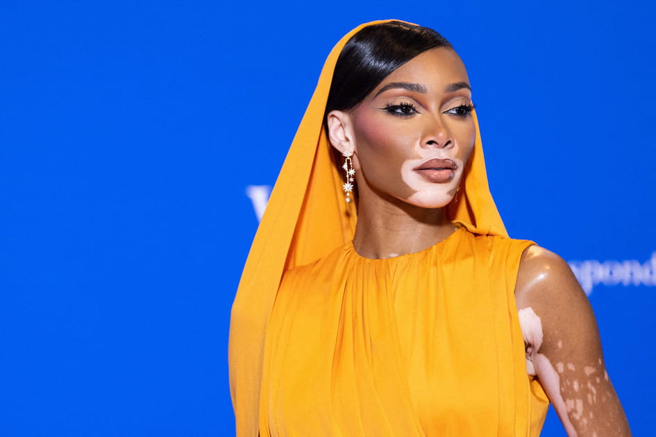 Poils, vergetures, cellulite... Ces stars qui assument ne pas &ecirc;tre dans les normes de beaut&eacute;