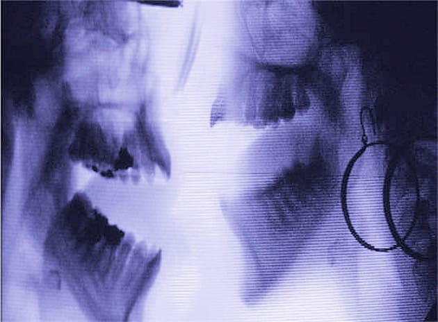 Un baiser vu aux rayons X