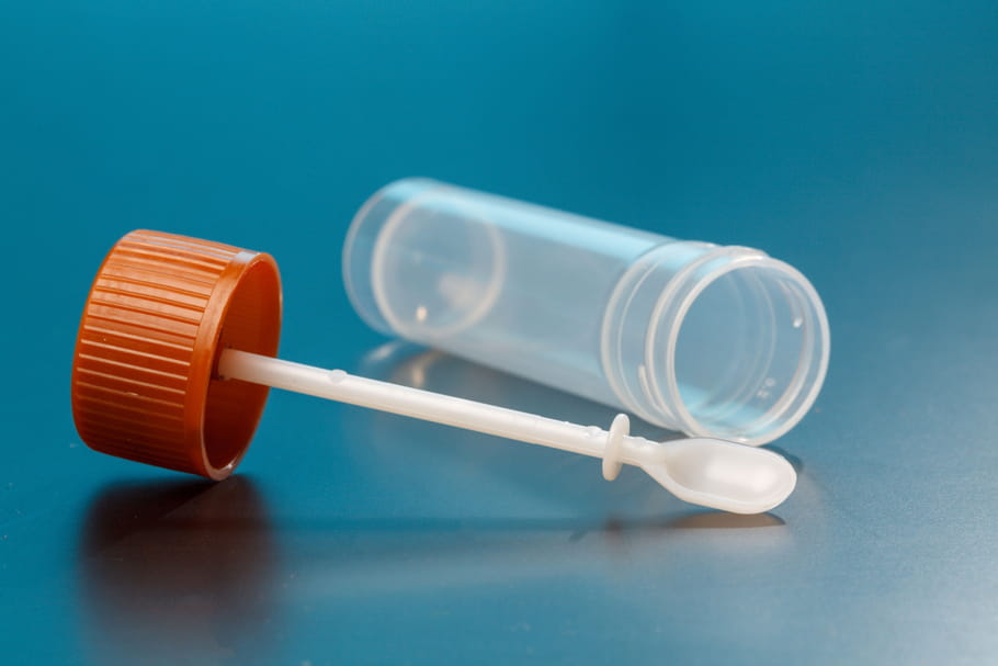 Examen parasitologique des selles : comment faire ?